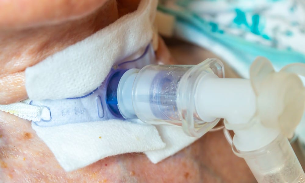 A close-up of a patient with a tracheostomy in their throat. There is a small piece of gauze on the skin around the insert.
